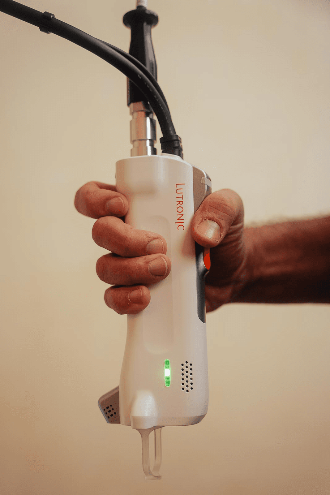 Laser hårfjerning behandling