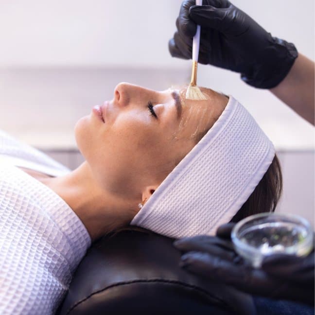 Kjemisk Peeling behandling